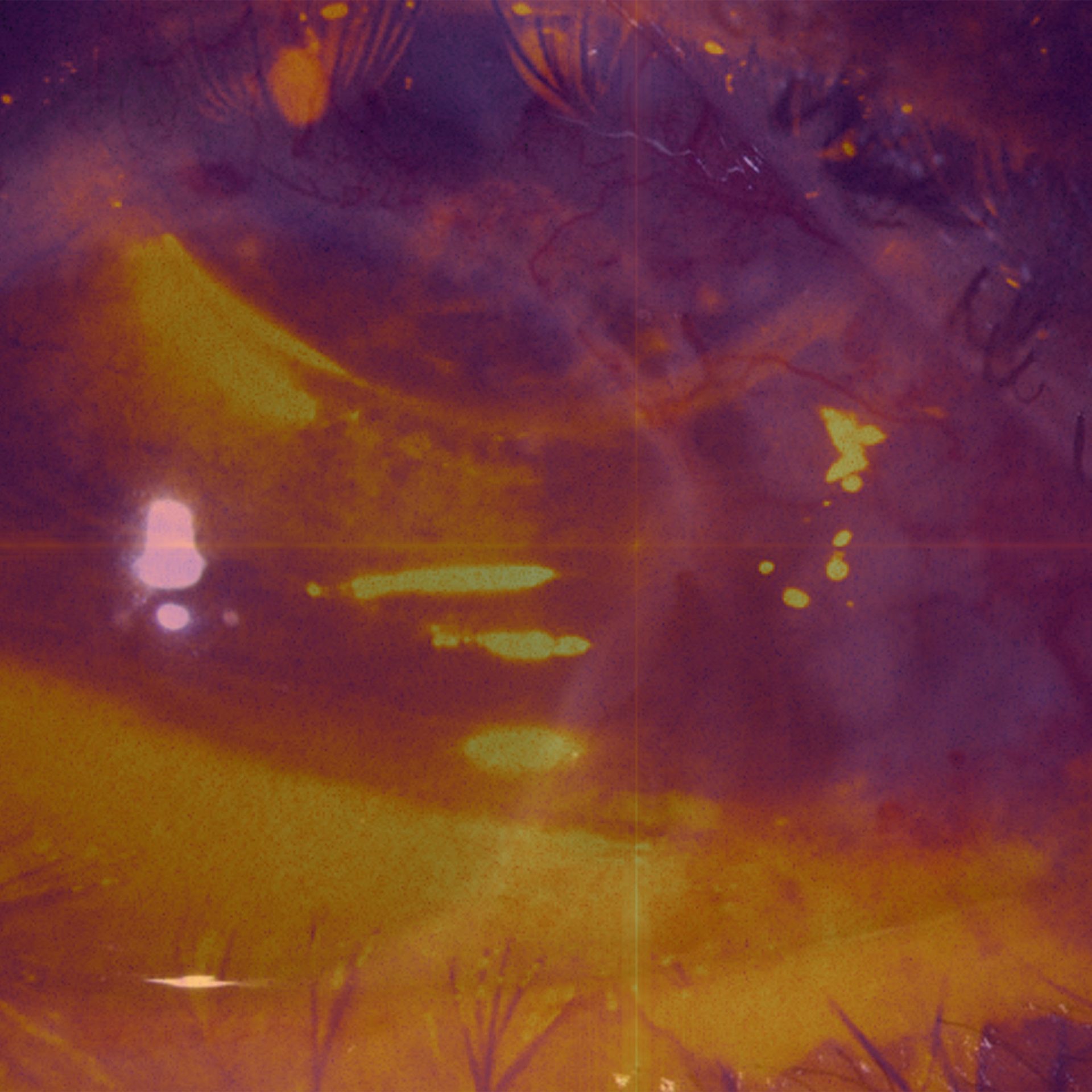 Supertriste estrena su disco debut «Bloop»